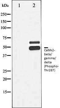 CaMk2-beta/ gamma/ delta (Phospho-Thr287) antibody