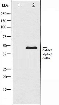 CaMk2 alpha/delta antibody