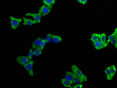 CAMK2N1 Antibody