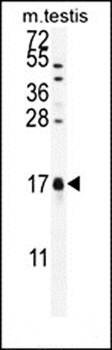 CAMK2N1 antibody