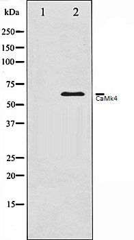 CaMk4 antibody