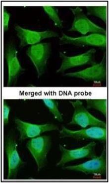 CaMKI delta Rabbit Polyclonal Antibody