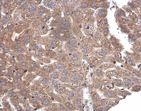 CaMKI delta Rabbit Polyclonal Antibody