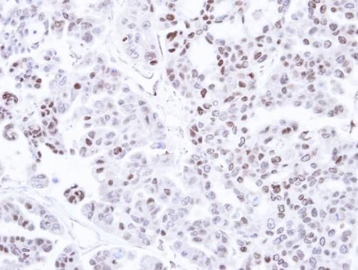 CaMKI delta Rabbit Polyclonal Antibody
