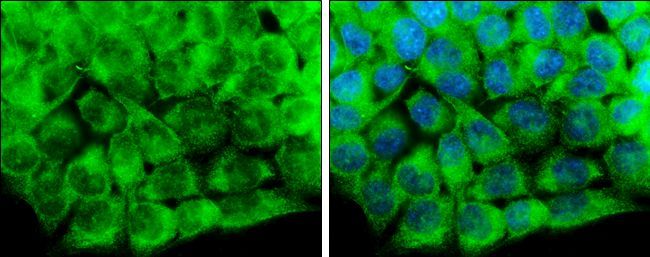 CaMKII delta antibody