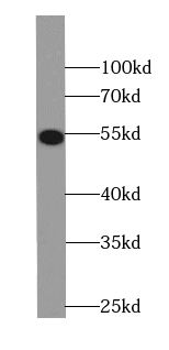CaMKII delta-Specific antibody