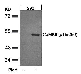 CaMKII (Phospho-Thr286) Antibody