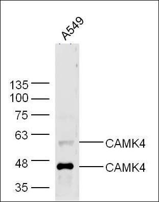 CAMKIV antibody