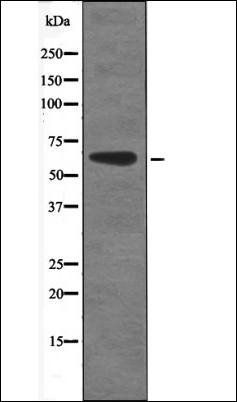 CAMKK1/2 (Phospho-Ser458/495) antibody