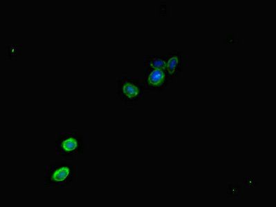 CAMTA1 antibody