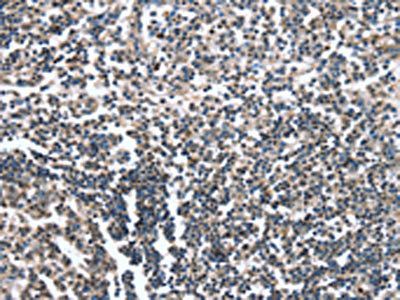 CAMTA1 antibody