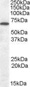 Goat anti-Cannabinoid Receptor 1 Antibody