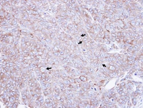 CAP1 Rabbit Polyclonal Antibody
