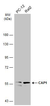 CAP1 Rabbit Polyclonal Antibody