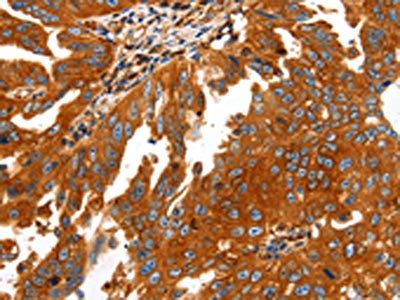 CAP2 Antibody