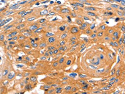 CAP2 Antibody