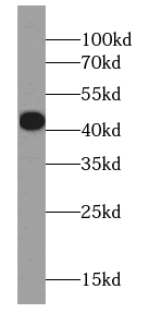 CAPG-Specific antibody