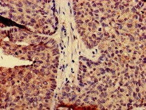 CAPN14 Antibody