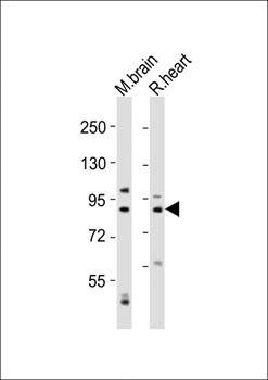 CAPN5 antibody