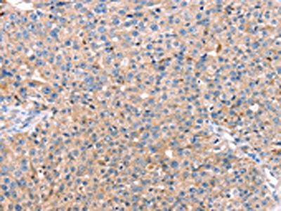 CAPN7 Antibody
