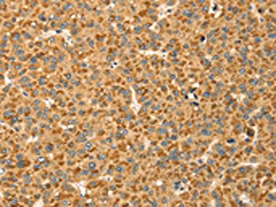 CAPN7 Antibody