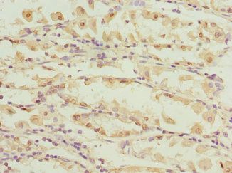CAPNS1 Antibody