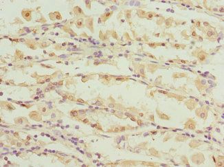 CAPNS1 antibody