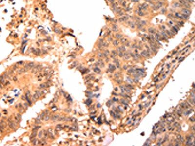 CAPNS1 Antibody