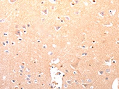 CAPNS1 Antibody