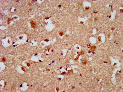 CAPS2 Antibody
