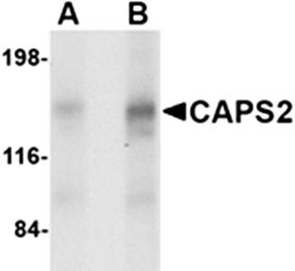 CAPS2 Antibody