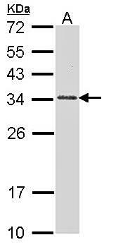 CapZ-beta antibody