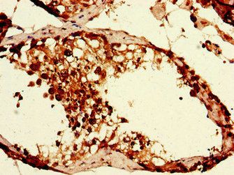CAPZA1 Antibody