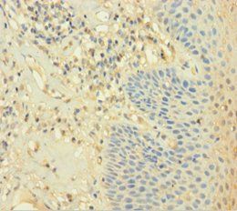 CAPZA2 Antibody