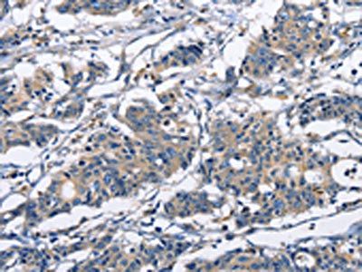 CAPZA2 Antibody