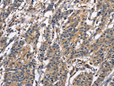 CAPZA2 Antibody