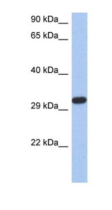 CAPZA3 antibody