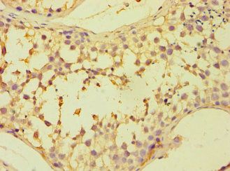 CAPZB Antibody