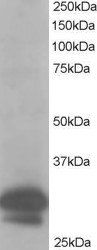 Goat anti-CAPZB Antibody