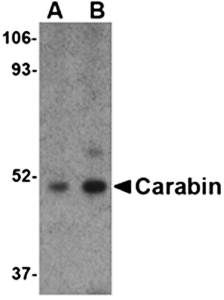 Carabin Antibody