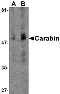 Carabin Antibody
