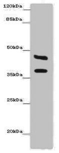 Carbonic anhydrase 12 antibody