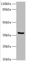 Carbonic anhydrase 12 antibody