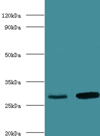 Carbonic anhydrase 1 antibody (HRP)