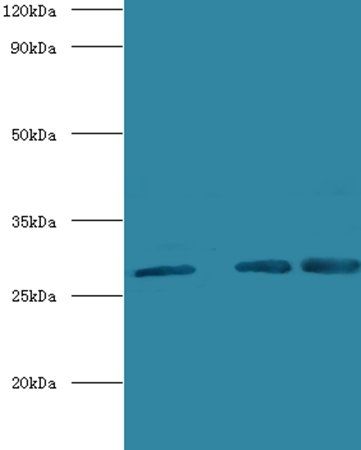 Carbonic anhydrase 1 antibody