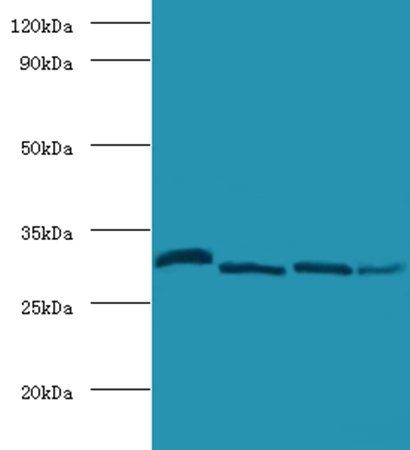 Carbonic anhydrase 2 antibody