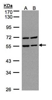 Carbonic anhydrase 9 antibody