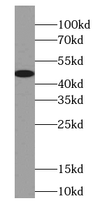 Carboxypeptidase A3 antibody
