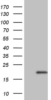 Carboxypeptidase B2 (CPB2) antibody