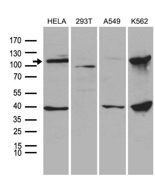 Carboxypeptidase M Antibody